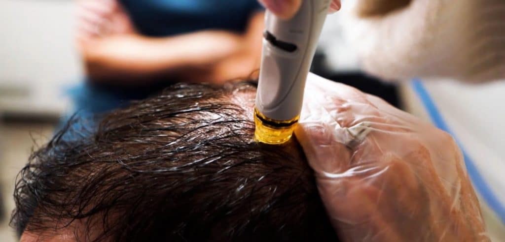 Understanding the benefits of HydraFacial Keravive for scalp health