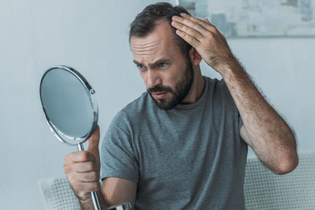 Bearded Middle Aged Man With Alopecia Looking At Mirror Hair