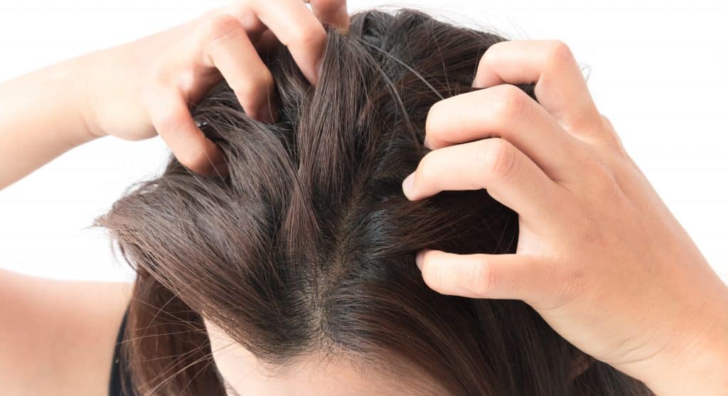 Closeup,Woman,Hand,Itchy,Scalp,,Hair,Care,Concept