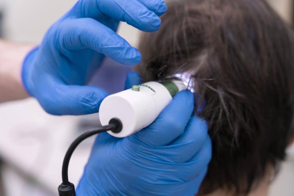 Solutions for Thinning Hair: Comparing Hair Loss Treatment in Singapore