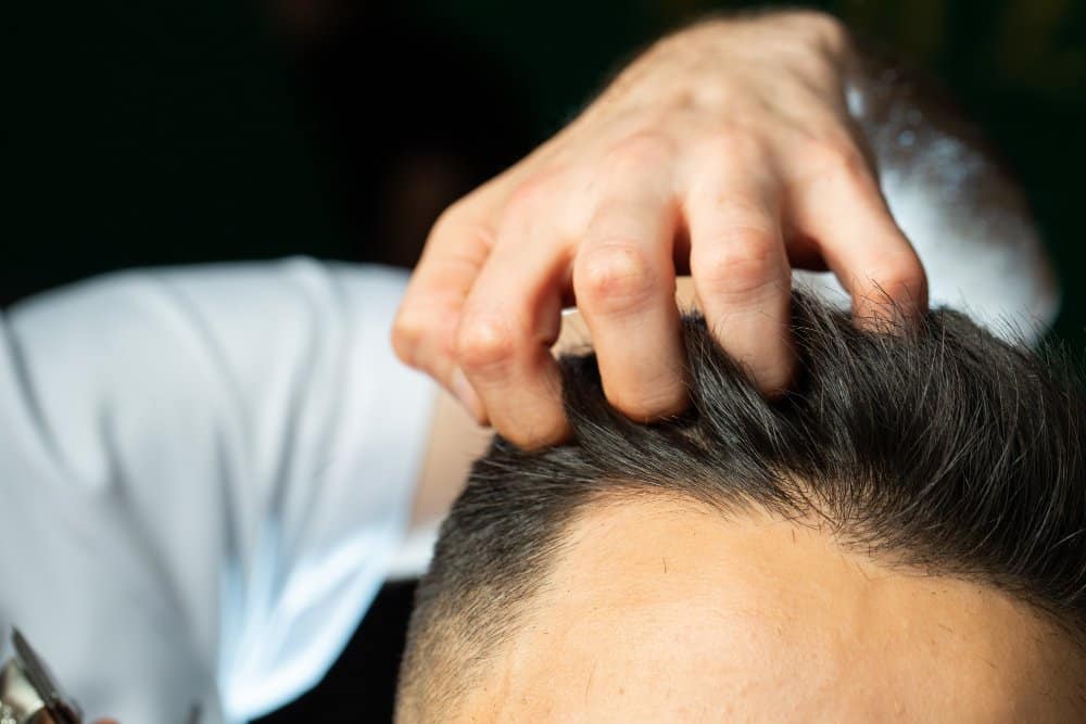 Finasteride in Singapore: Costs, Results & Medical Guide